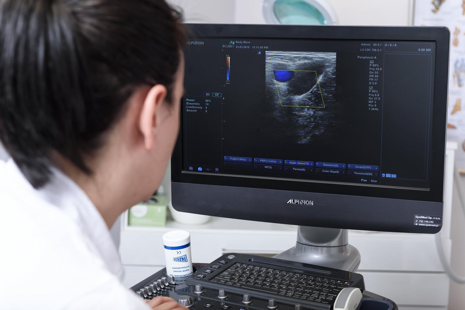 Ilustracja do artykułu: Nowoczesna diagnostyka medyczna: Uszlachetnione zastosowanie USG śledziony